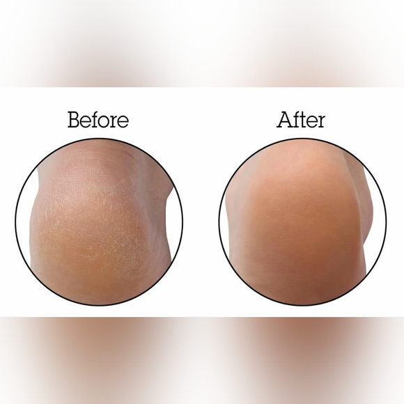 XL Pro Foot File by Microplane - Picture 5 of 7